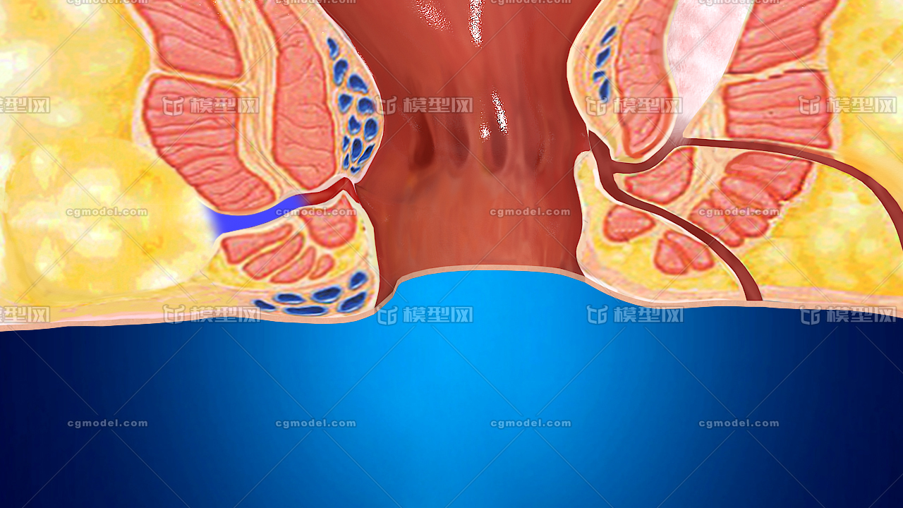 医学动画,肛肠镜,外肛肠科,肠道内视,外科,内痔,痔疮发生,人体解刨