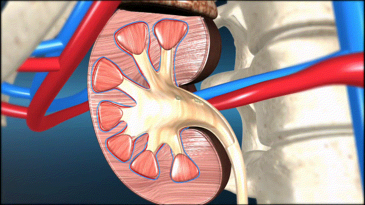医学动画,肾结石带动画,肾脏剖面,人体器官,解剖,男性泌尿系统 生殖