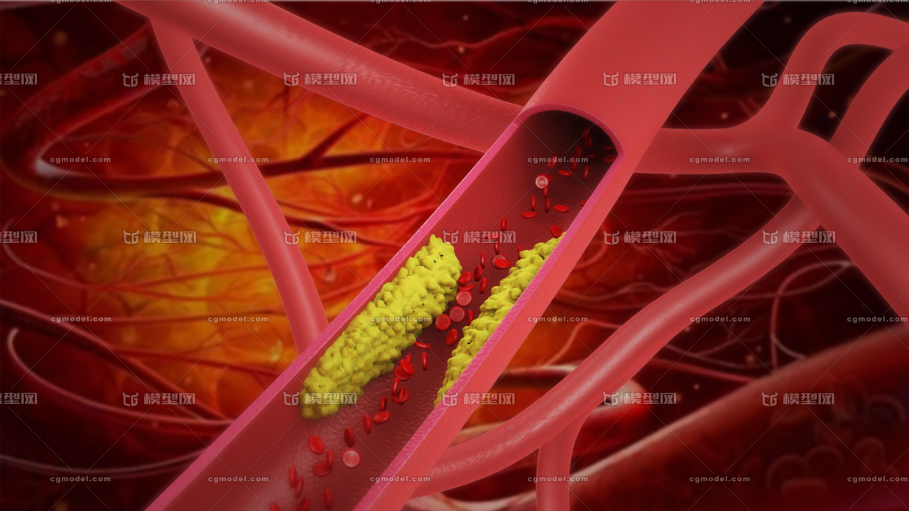 《医学系列》血管,血栓,心脑血管,微观结构,医学模型