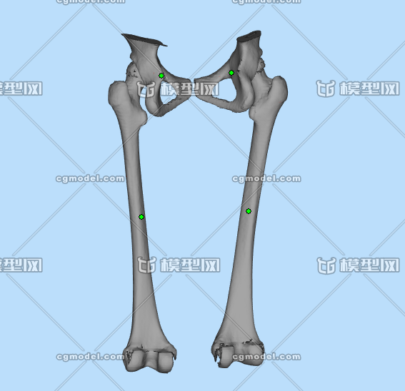 盆骨 髖關節 股骨 醫療模型cbct提取逆向建模