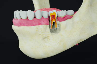 牙齿内部结构 牙齿剖面 口腔内部 口腔结构 人体器官模型 医学模型