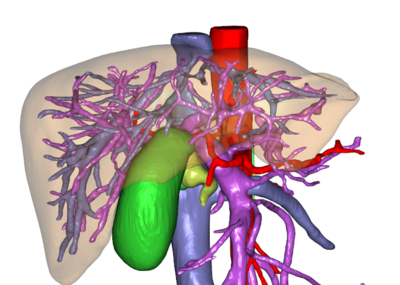 肝脏血管模型图片