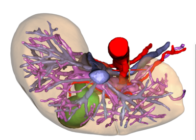 肝脏血管模型图片