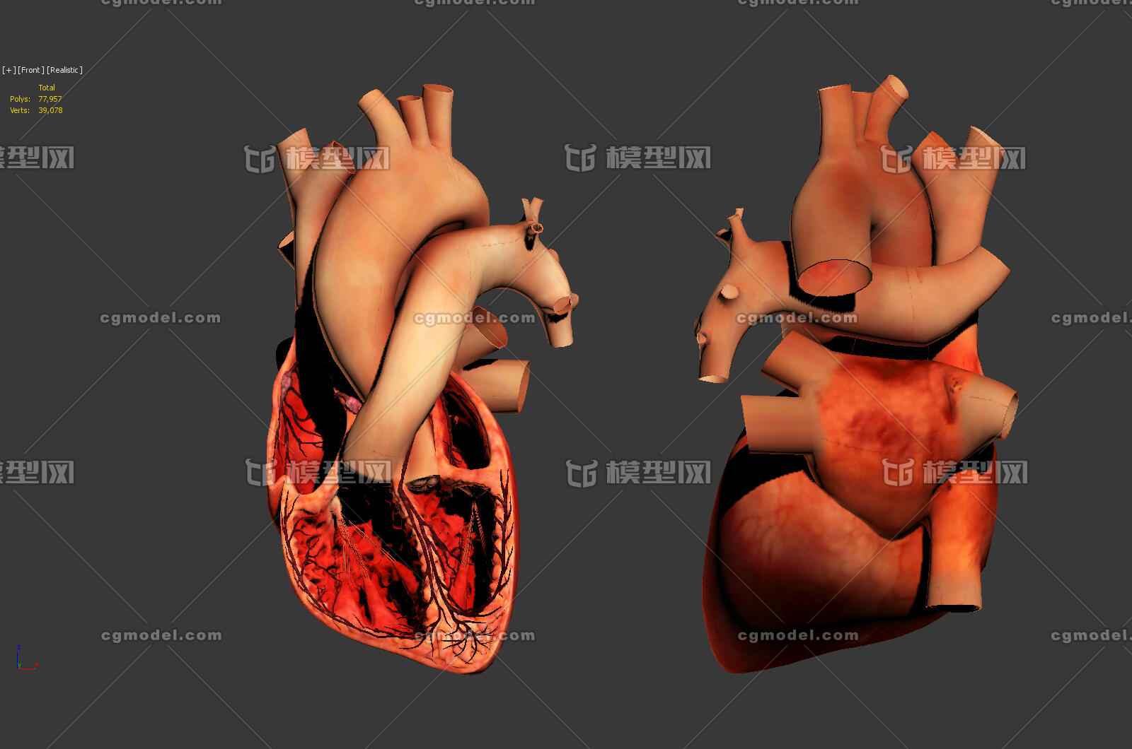 剖面 半个心脏 人体心脏 医学模型 解刨模型 高精度 真实心脏模型 带
