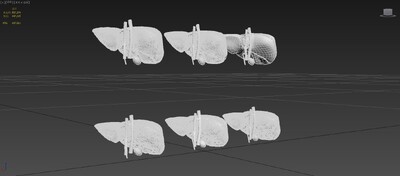 肝脏疾病 脂肪肝模型-人体器官模型库-3ds Max(.max)模型下载-cg模型网